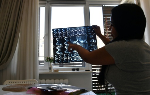Diana Tergenbaïeva, victime d'une opération ratée de chirurgie esthétique, montre une IRM lors d'un entretien avec l'AFP à Bichkek, le 15 mai 2026 au Kirghizstan — Vyacheslav OSELEDKO / AFP