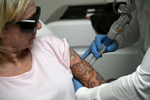 El doloroso tratamiento requiere varias sesiones — Nicolas TUCAT / AFP