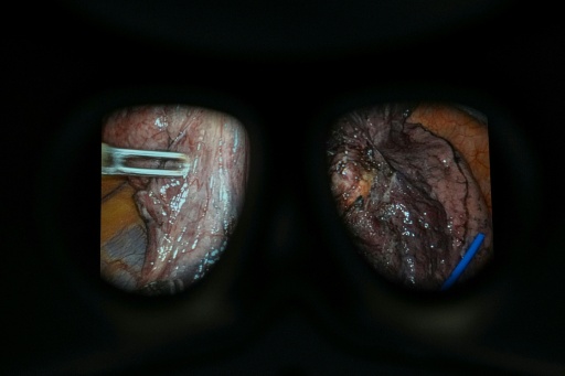 Le gouvernement s'est fixé pour objectif que la chirurgie robot-assistée soit utilisée dans neuf interventions par cœlioscopie sur dix en Angleterre d'ici à 2035 — CARLOS JASSO / AFP